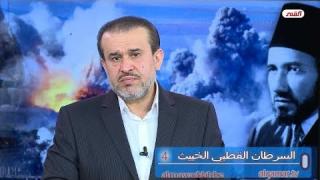 الشيخ عبد الحليم الغزِّي